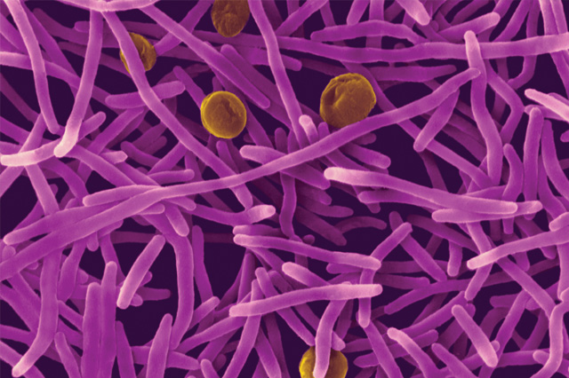 purple e coli bacteria