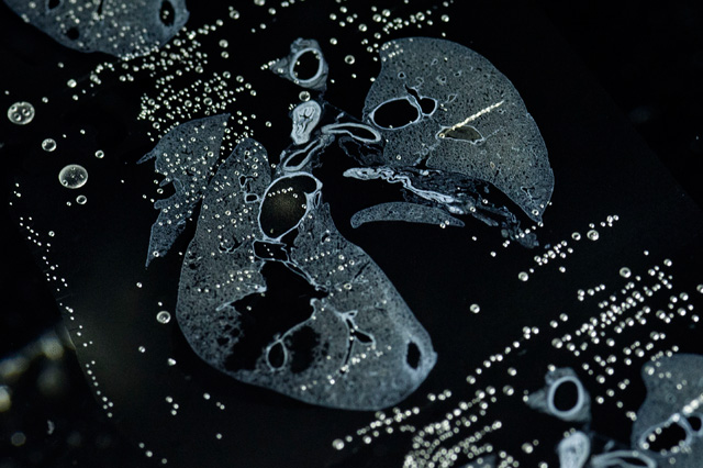 lungs