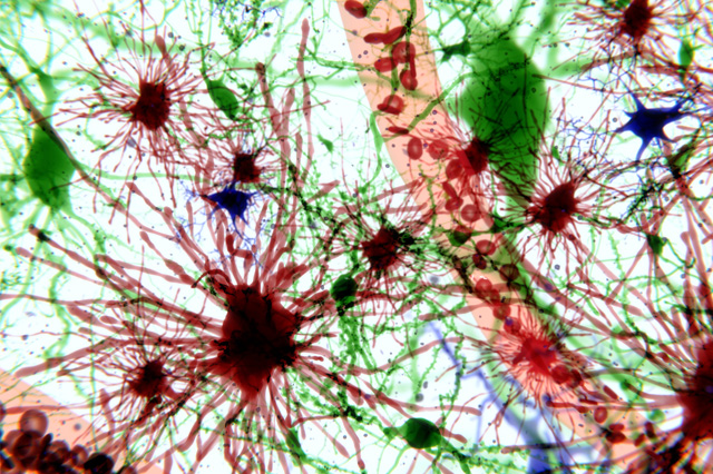neurons