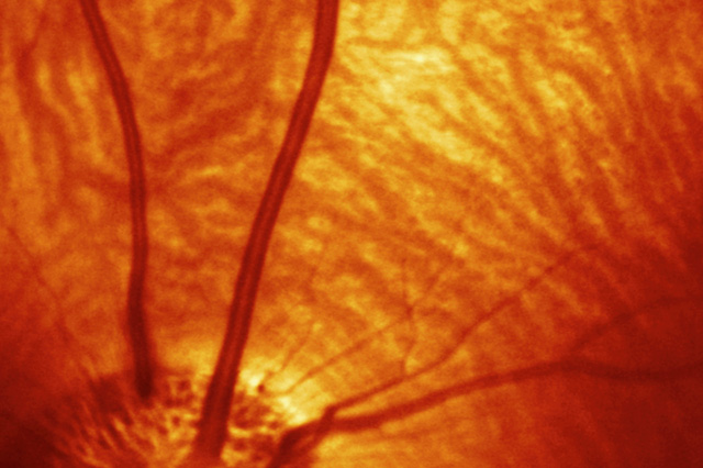 opthalmology