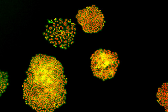 Patient-derived cells used for in vitro assay development. 