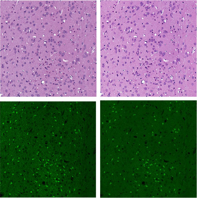 Images of standard and chemical free virtual stains