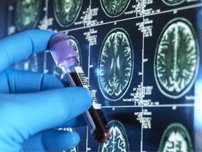 Blood test in front of MRI brain images