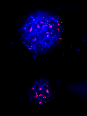 CYPRE TUMOR MODEL -- Combination Cancer Therapy article