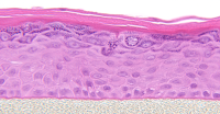 EpiDerm In Vitro Assay for Medical Device Testing