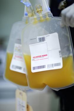 Apheresis collects white blood cells like these for research