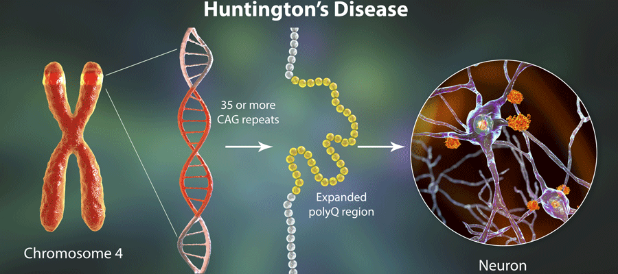 Huntington's disease graphic