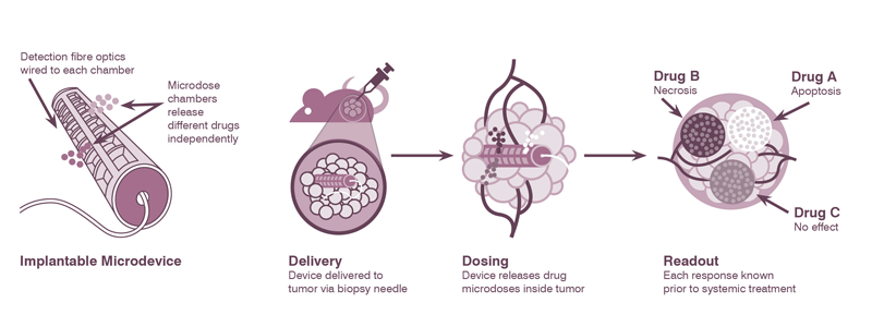 Schematic of Kibur implantable microdevice technology