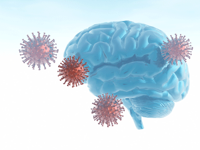 Brain fog from long COVID