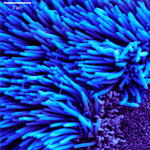 Electron micrograph of lung trachea