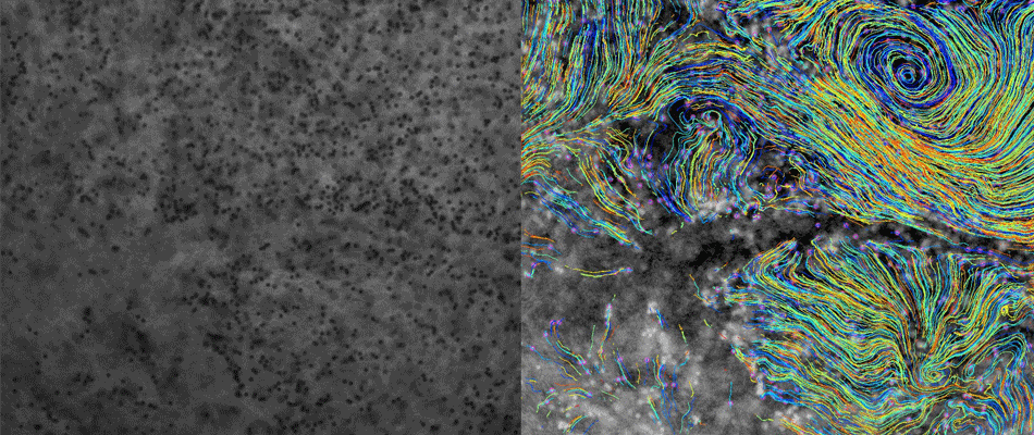 Representative Images of Microbeads on Tissue With & Without Tracks