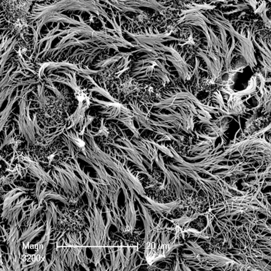 Scanning Electron Microscopy image showing tissue surface morphology