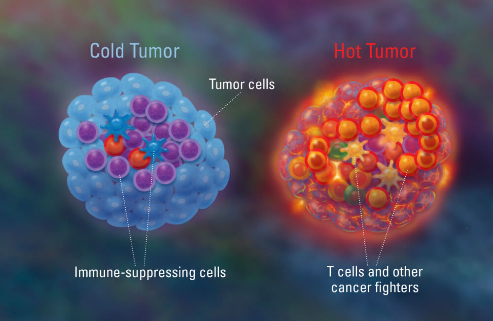 Hot Tumors vs Cold Tumors | Charles River
