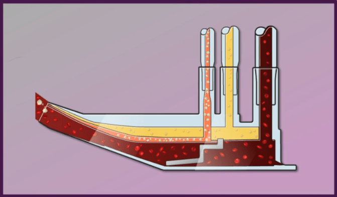 Graphic sowing the separation of blood fractions during leukapheresis, showing the three different cell layers and outlets for each layer.