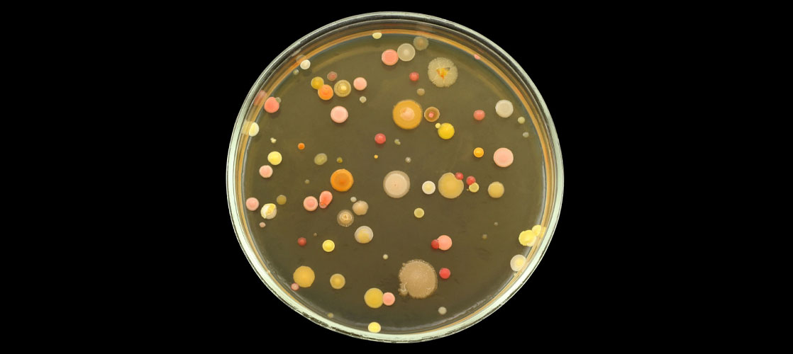 Agar plate