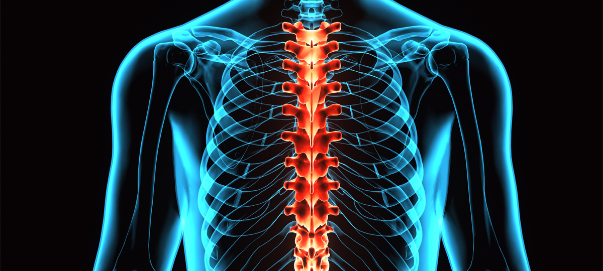 Neuroinflammation in Spinal Cord Injury: A Necessary Evil