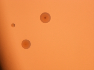 Agar plates inoculated with Mycoplasma pneumoniae