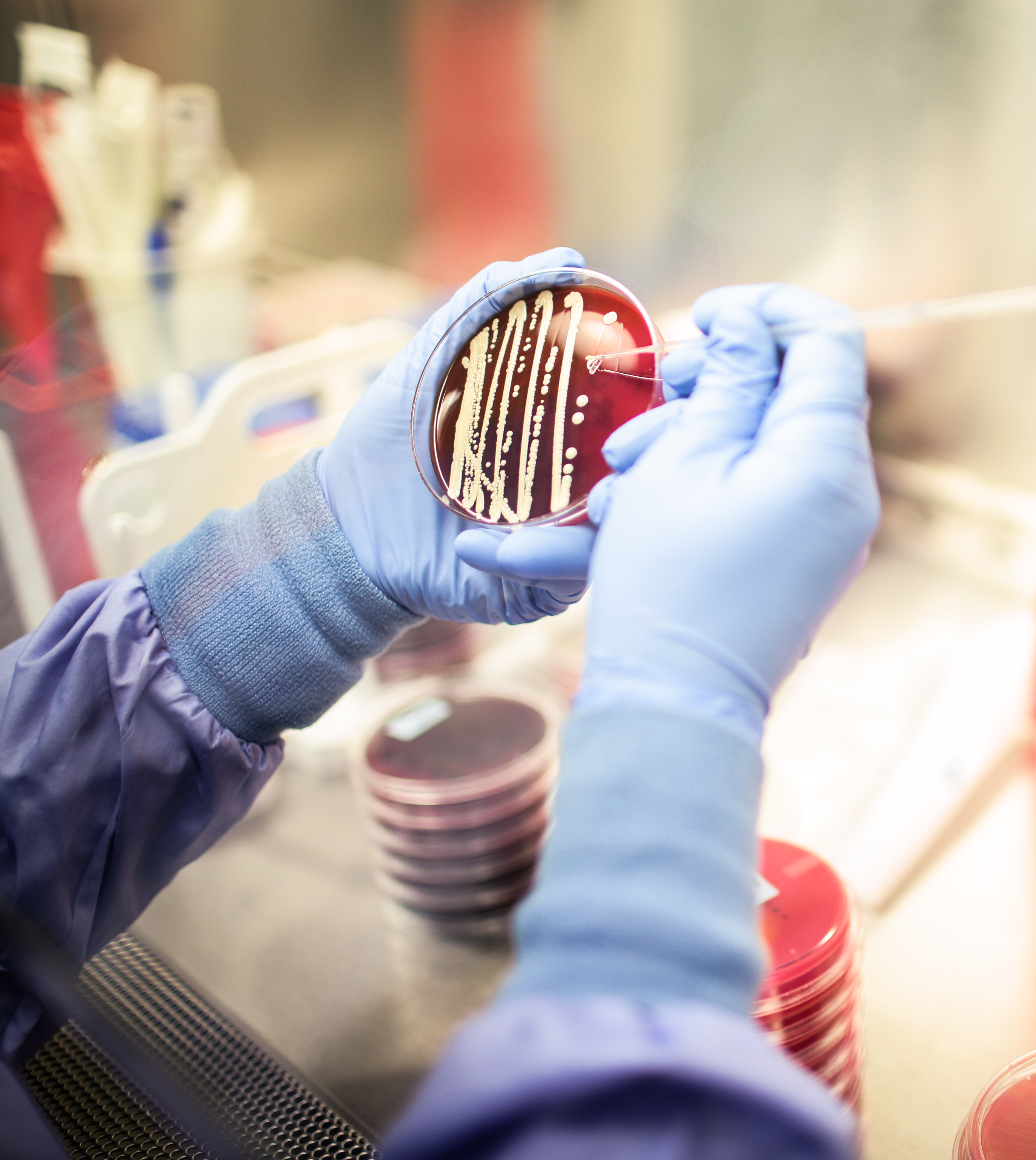 Scientist evaluating microbial identification and strain differentiation test results on agar plate