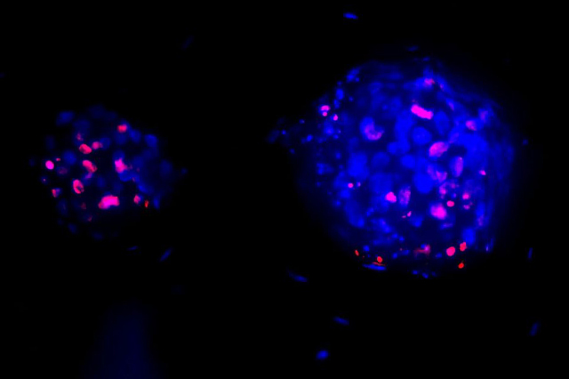 Image of 3D cell models used for drug development