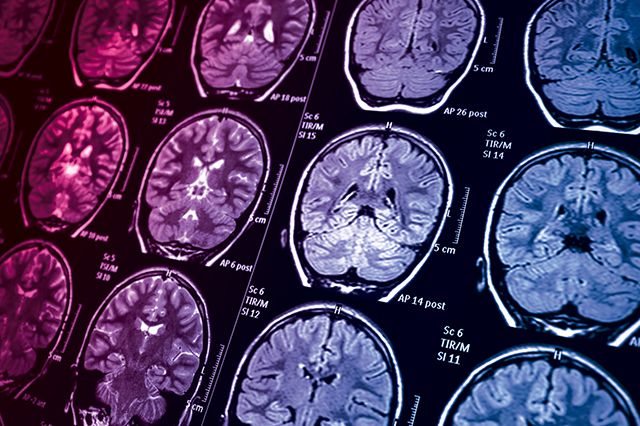 Image of brain scans with overlay of Vital Science colors.