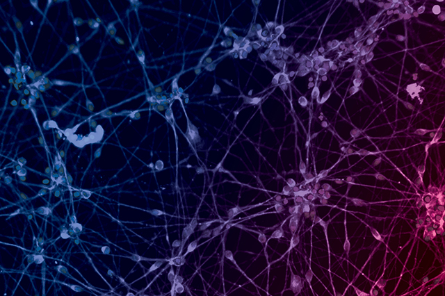 Cancer cells overlaid with the Vital Science colors.