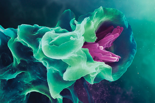 The anti-infective role of the immune system on E.coli infection