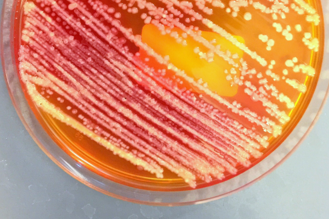 Agar plate with environmental isolate sample that can be identified with relevant microbial databases