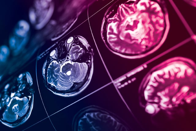 Photo of brain scans overlaid with vital science colors.