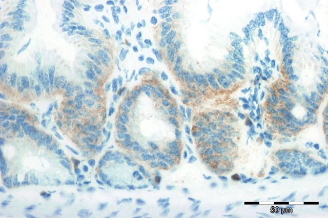 Tissue Binding Expertise for Your Antibody Development