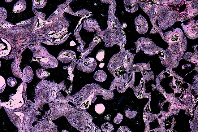 medical device image
