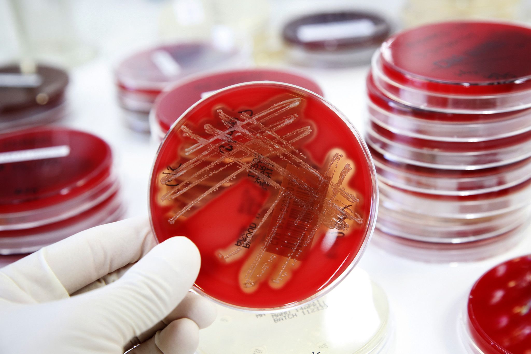 microbial sample in hand of lab worker