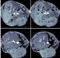 Example of Anatomical Imaging.