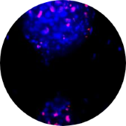 Charles River offers ex vivo Anti-Tumor Efficacy Screens using 3D Tumor Models.