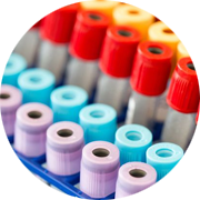 Binding of antisense oligonucleotide to RNA for use in Antisense oligonucleotide therapy.