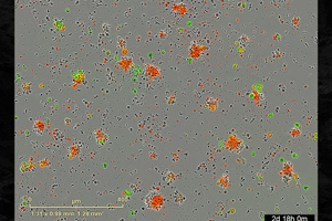 Gene expression analysis provides information on changes in tumor growth and mechanism of action.