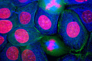 Pathology, histology and immuno-histochemistry provides additional data for in vivo oncology models.