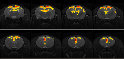 Functional MRI brain imaging of chemically induced pain from AITC injection in rats
