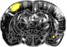 Functional US brain imaging of Individual statistical activation map of unilateral whiskers stimulaion in mice