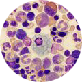 Clinical sample analysis and clinical biomarker analysis services supports the decision to progress your oncology drug.