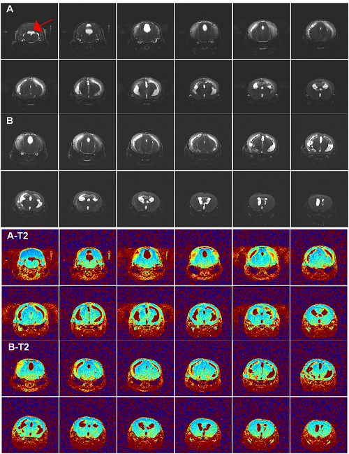 In vivo imaging in pediatric PDX glioma model 