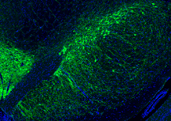 A immunohistochemistry image of a brain slice with tyrosine hydroxylase stained dopaminergic neurons in the striatum.