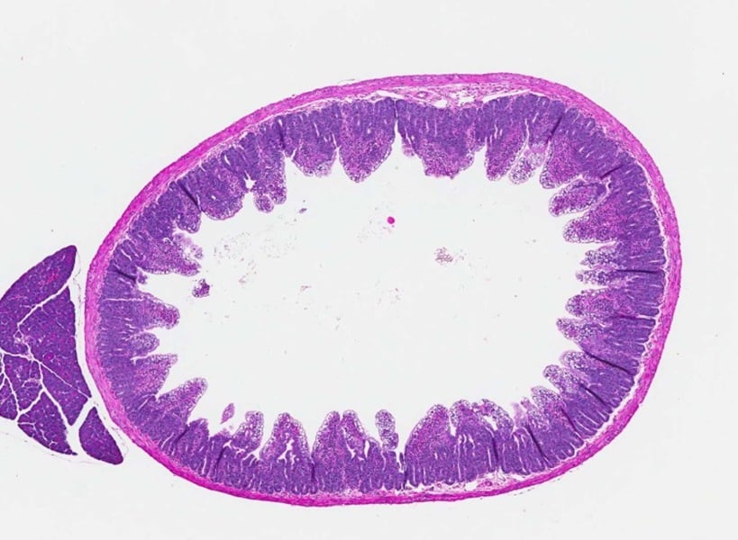 duodenum transverse section from a mouse 24 hours after injection of polyinosinic-polycytidylic acid (poly I:C)
