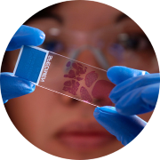Pathologist examining histopathology slide