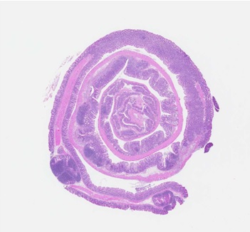 H&E stained section of colon from TNBS-treated mice