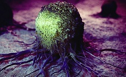 Tumor Cell.