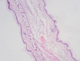 Histopathology of control skin in ovalbumin induced model of atopic dermatitis.