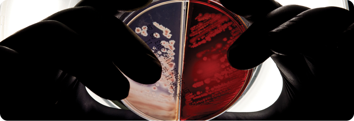 Gloved hands hold up a petri dish divided into two sections, one containing a red agar medium with bacterial growth and the other a lighter medium with visible colonies, illuminated from behind.