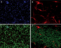 Disease relevant in vitro assays for ALS in motor neurons derived from control patient iPSCs.