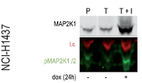 Disease relevant in vitro assays for ALS in motor neurons derived from control patient iPSCs.