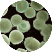 Cell culture of a Urinary Tract Infection.